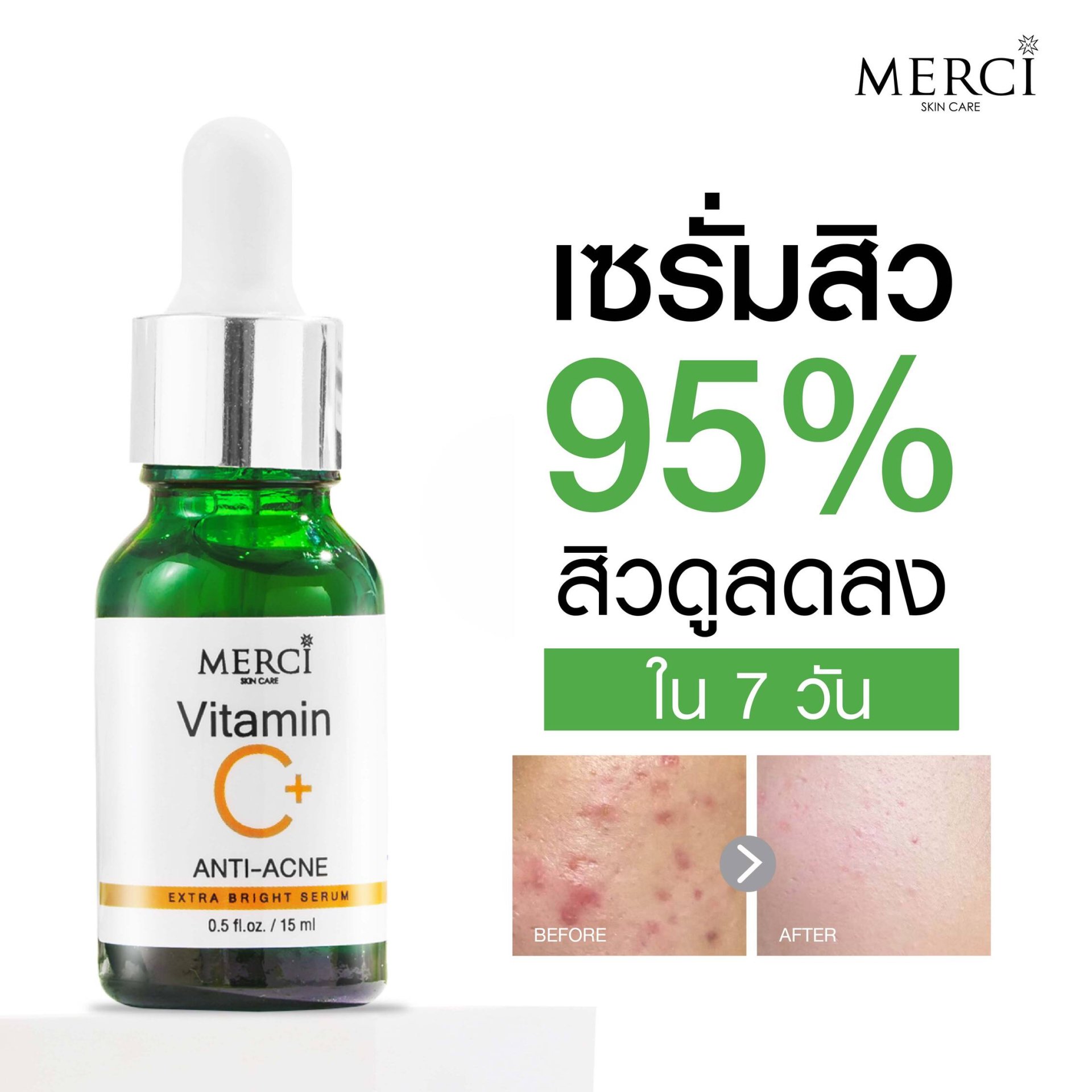 Merci Vitamin C Anti-Acne Extra Bright Serum 15 ml.